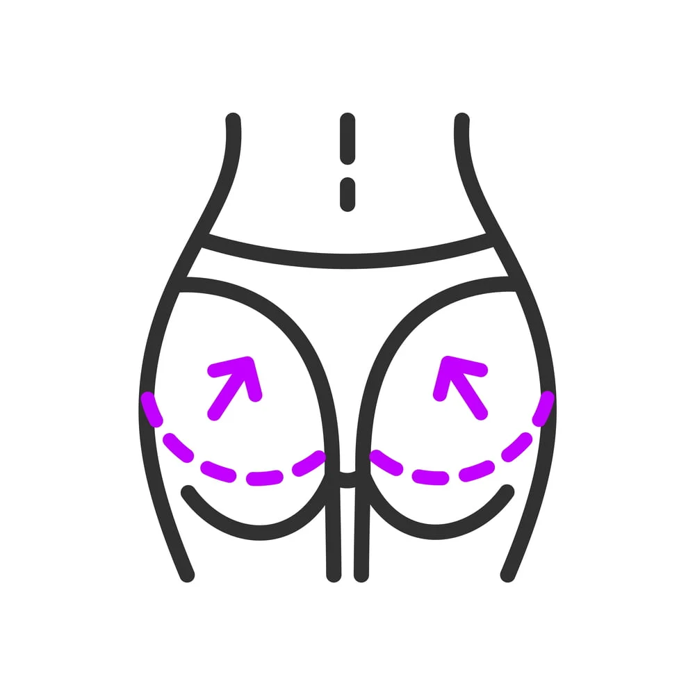 Thigh lift