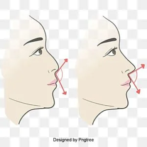 عملية تجميل الأنف 