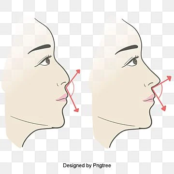 عملية تجميل الأنف