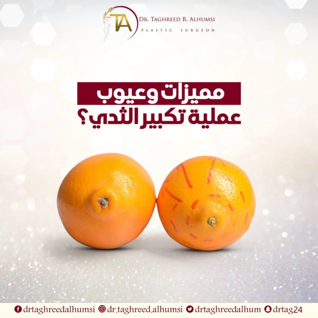 مميزات وعيوب عملية تكبير الثدي