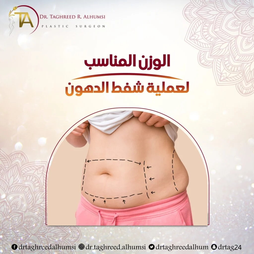 الوزن المناسب لعملية شفط الدهون