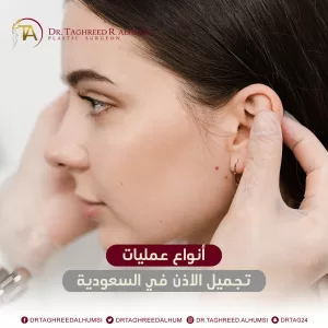 أنواع عمليات تجميل الأذن في السعودية 