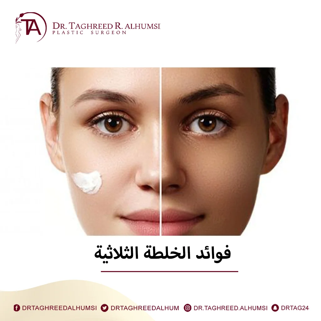 الخلطة الثلاثية