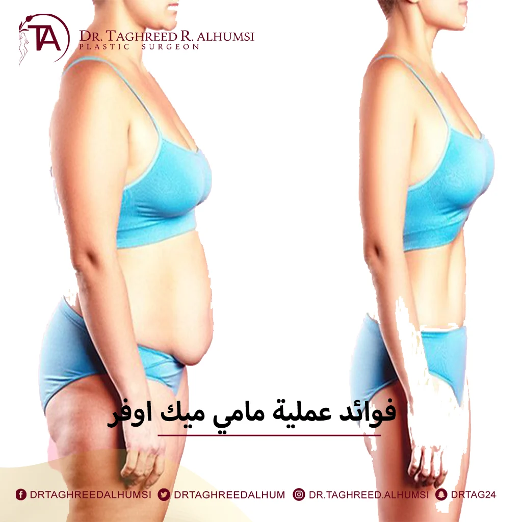 عملية مامي ميك اوفر 