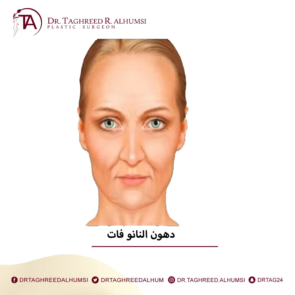 دهون النانو فات