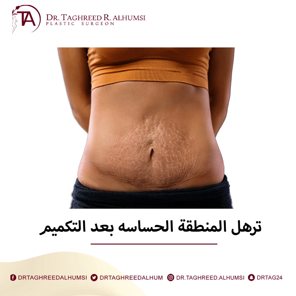 ترهل المنطقة الحساسه بعد التكميم