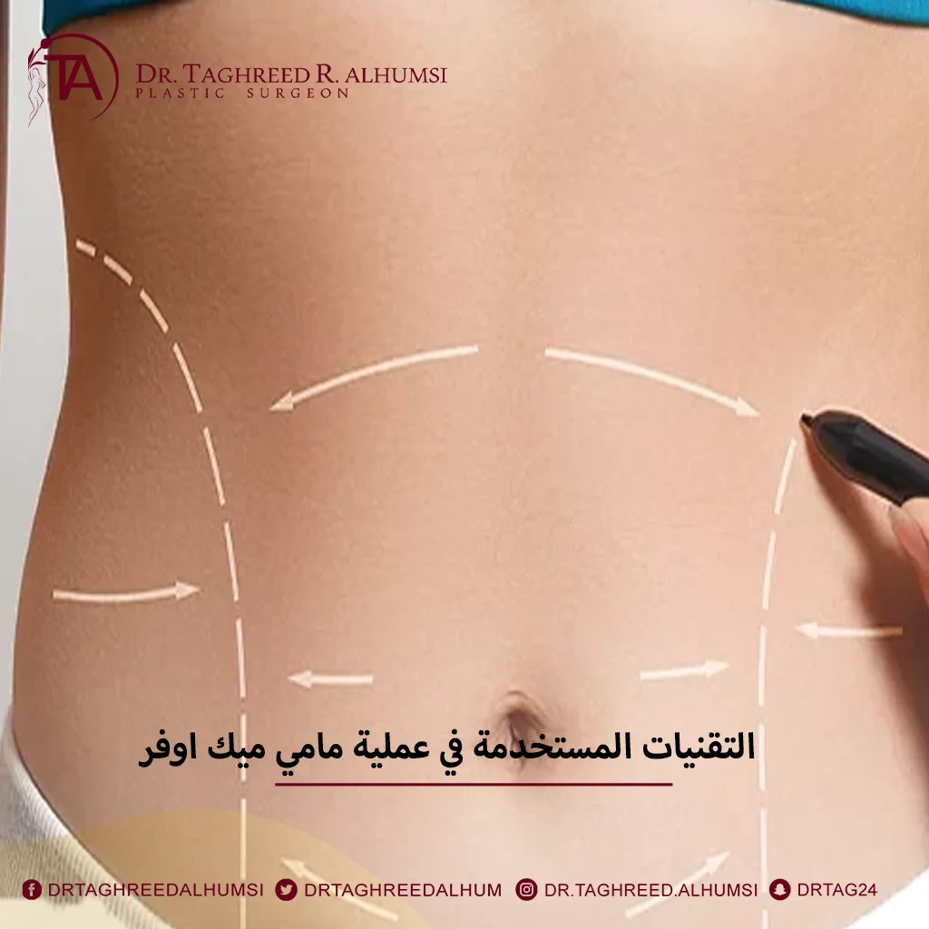 التقنيات المستخدمة في عملية مامي ميك اوفر
