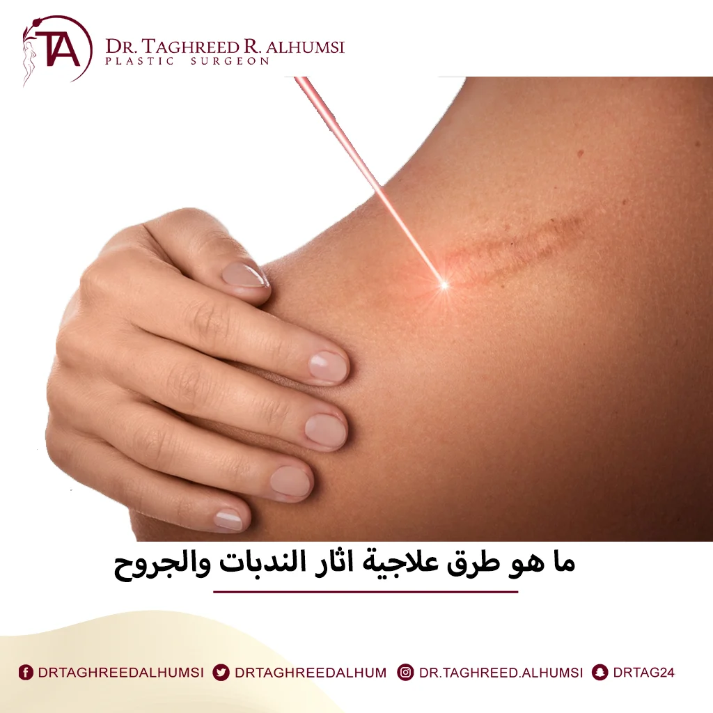 علاج اثار الندبات والجروح