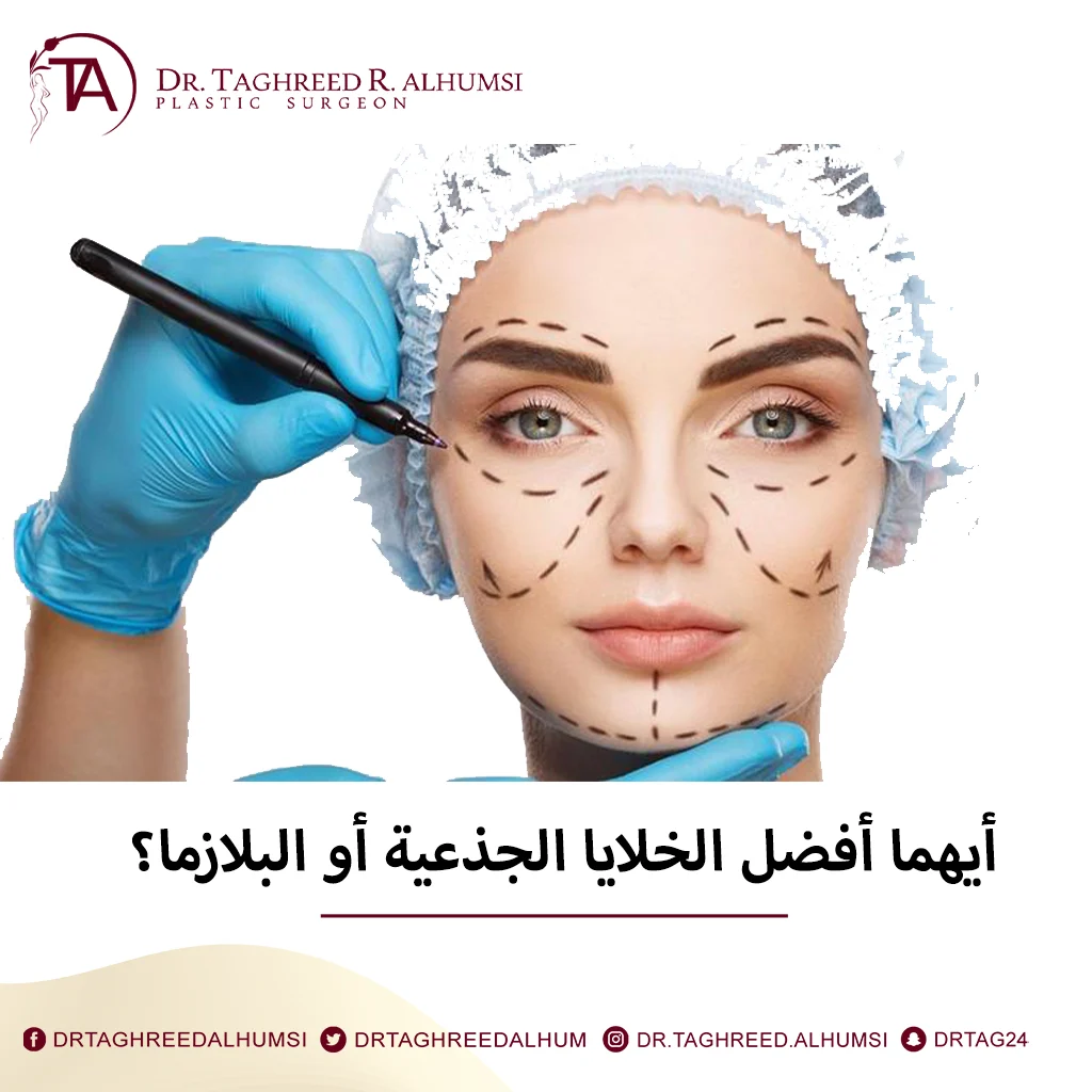 أيهما أفضل الخلايا الجذعية أو البلازما؟