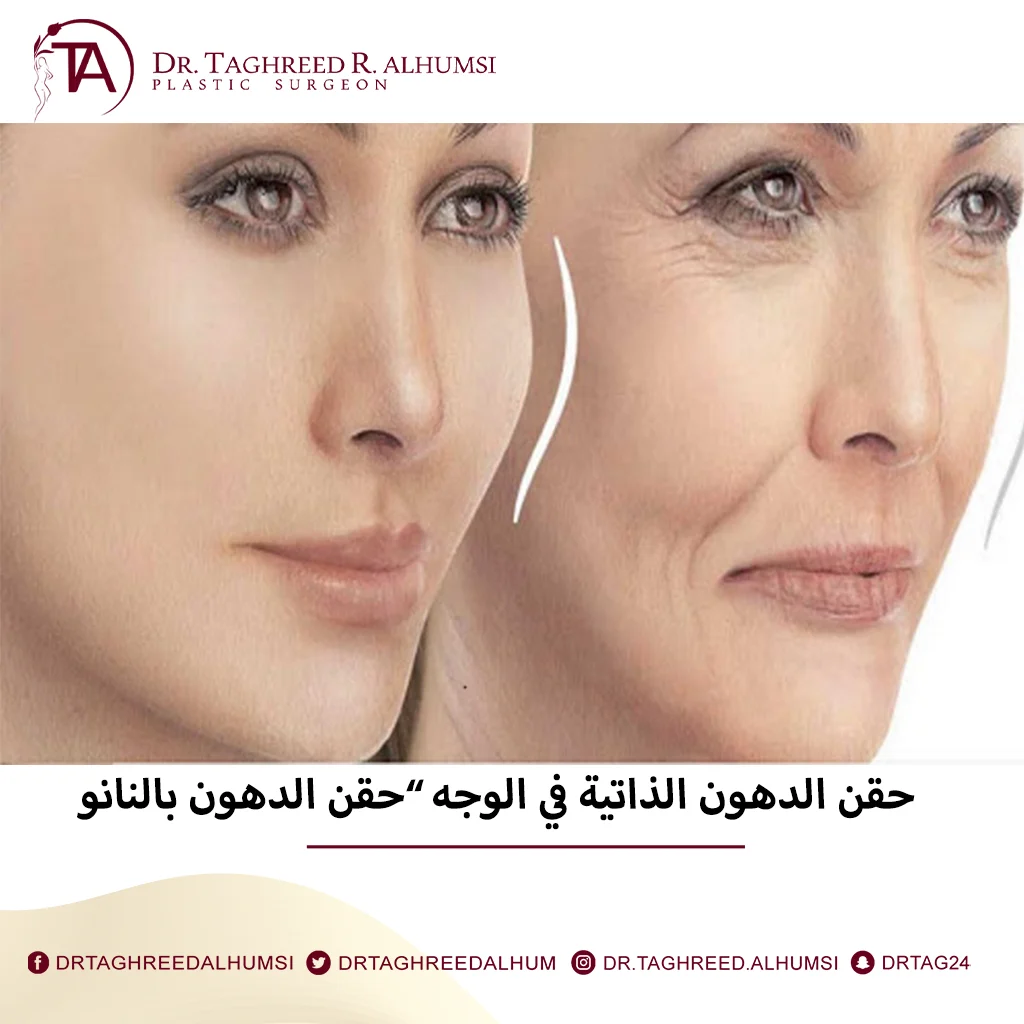 علاج اثار الندبات والجروح