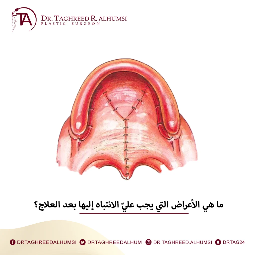 ما هي الخيارات العلاجية المتاحة للفك المشقوق ؟