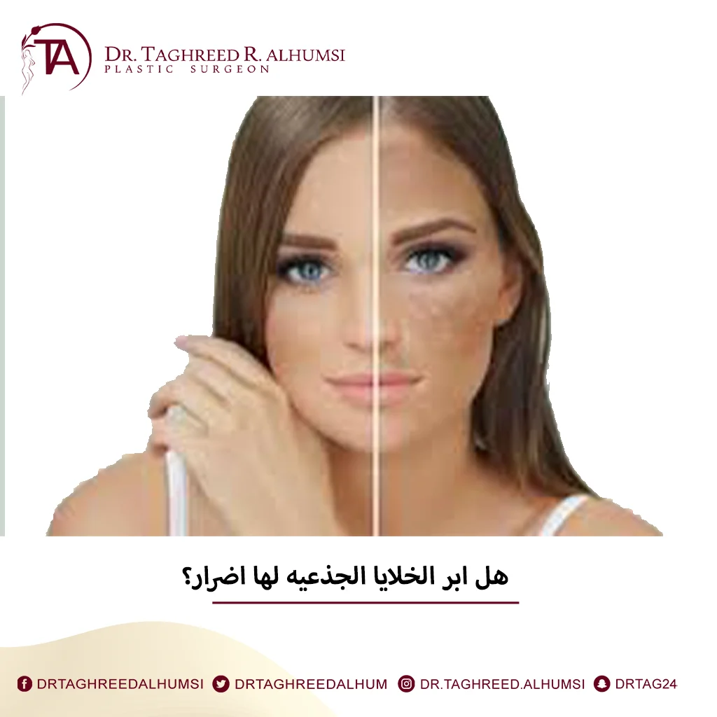 هل ابر الخلايا الجذعيه لها اضرار؟