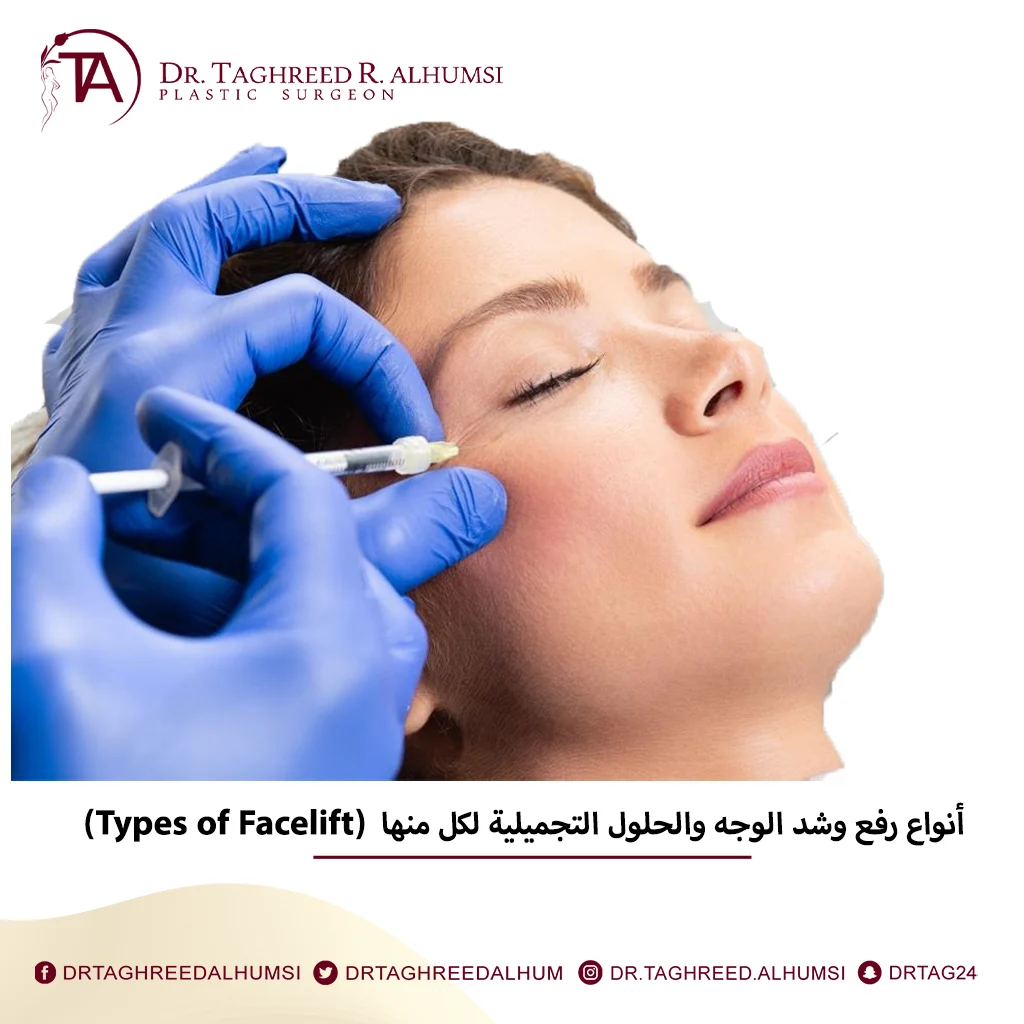 أنواع رفع وشد الوجه والحلول التجميلية لكل منها (Types of Facelift)