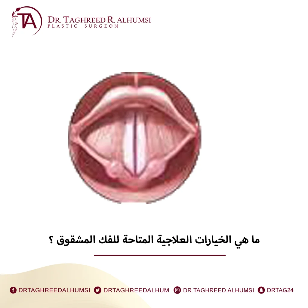 ما هي الخيارات العلاجية المتاحة للفك المشقوق ؟