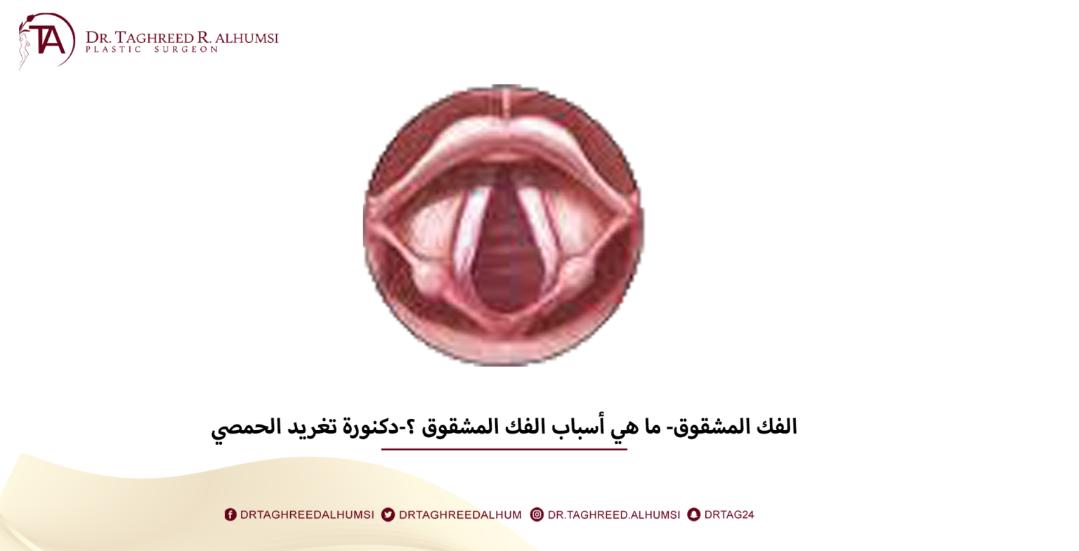 الفك المشقوق