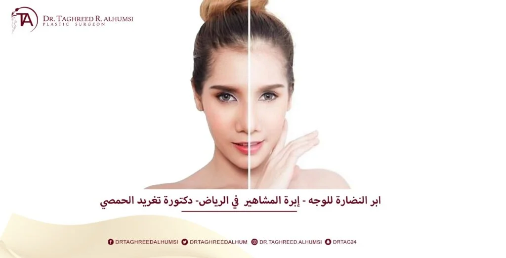 ابر النضارة