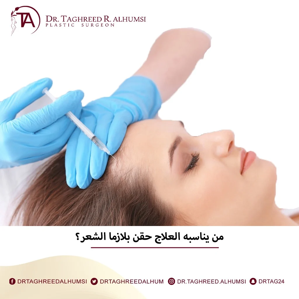 حقن البلازما للشعر