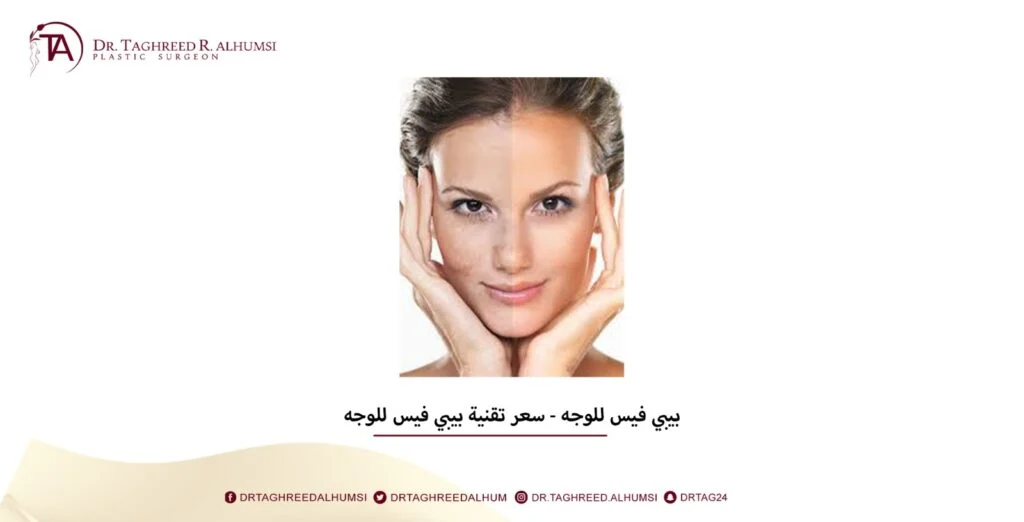 بيبي فيس للوجه - سعر تقنية بيبي فيس للوجه