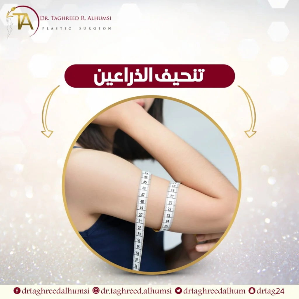 شد وشفط الذراعين بعد التكميم